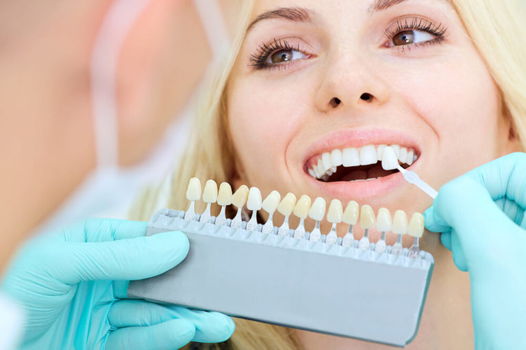 A dentist holds a whitening scale next to a female dental patient's teeth to compare degrees of whiteness