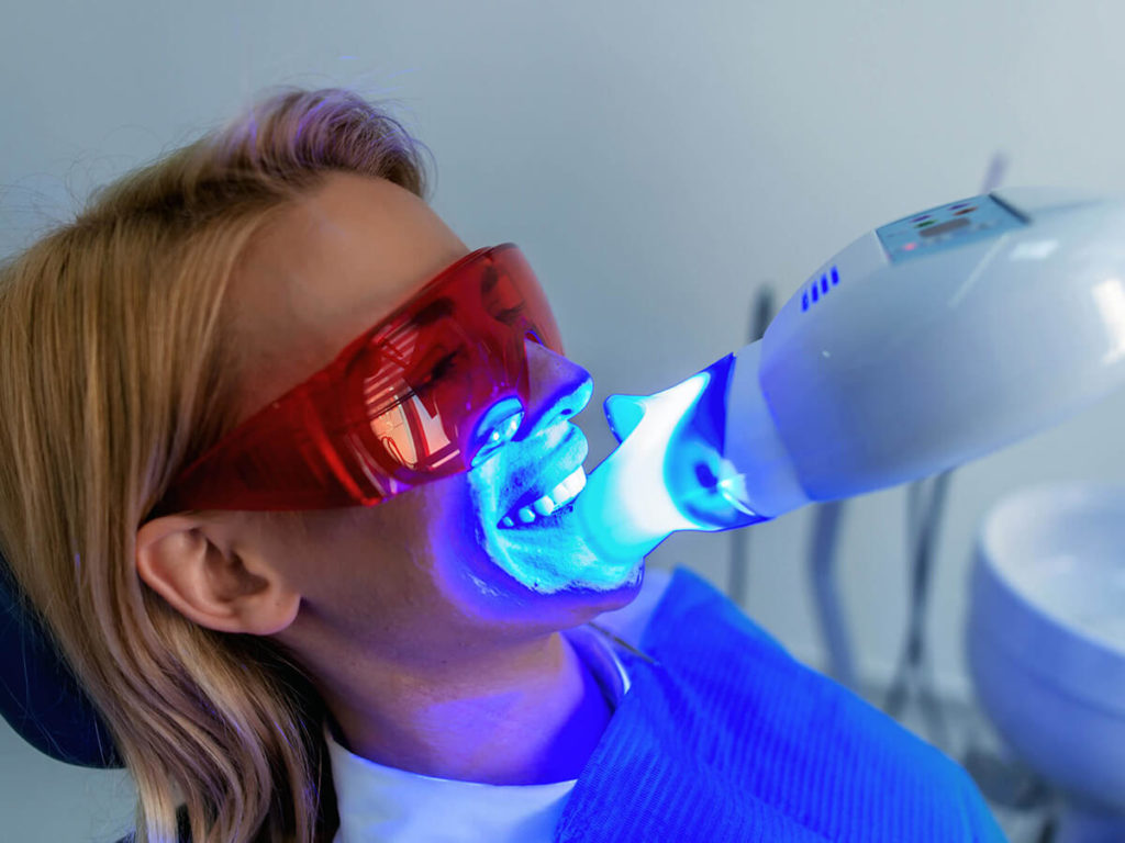 Teeth Whitening Using Uv Light at Terry Flesher blog
