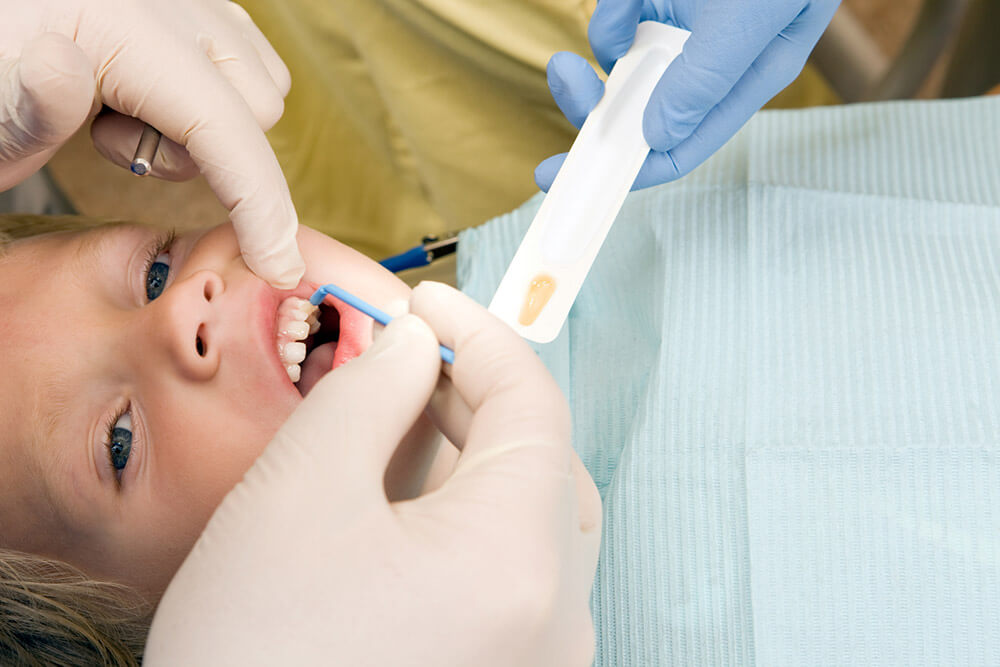 What is the Role of Fluoride in Dental Care? Drum Hill Dental